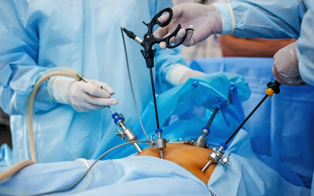 Laparoscopic Gynecology Surgery in Indore