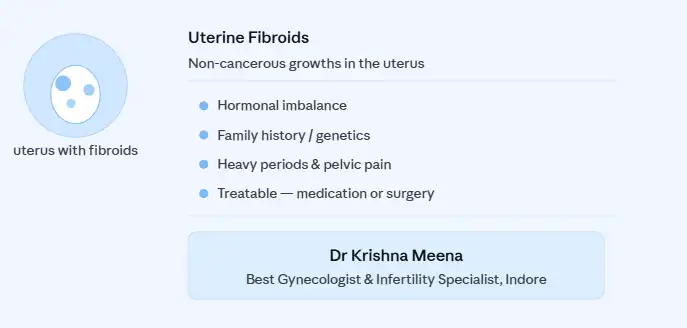 Uterine Fibroids